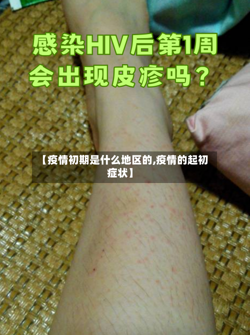 【疫情初期是什么地区的,疫情的起初症状】-第2张图片