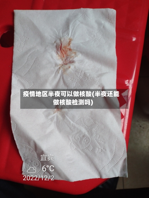 疫情地区半夜可以做核酸(半夜还能做核酸检测吗)-第1张图片